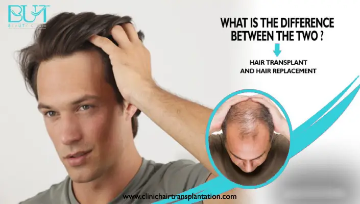 تفاوت کاشت مو با ترمیم مو چیست
